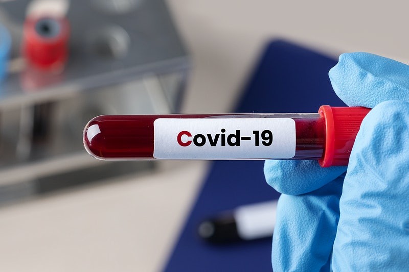 covid-19-updates-health-ministry-announces-the-use-of-plasma-to-treat-covid-19