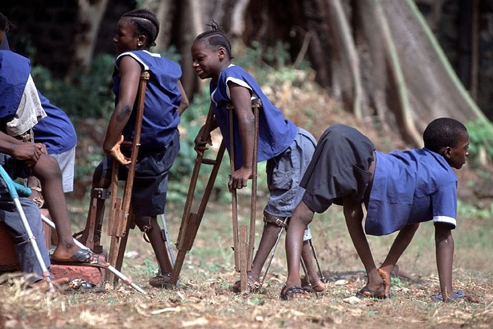 Government Confirms Outbreak Of Polio Virus In Uganda